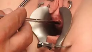 কালো কেশিক শৃঙ্গাকার ...